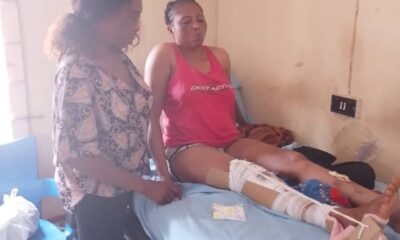 NWFL star Ifeoma Marvellous Onwuegbuchulam appeals for N3.5m to undergo life-saving corrective surgery after devastating accident