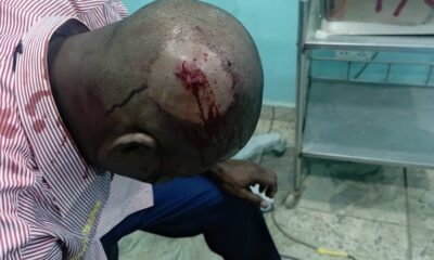 Wikki Tourists Clarify Circumstances Surrounding Injury to Katsina United Chairman