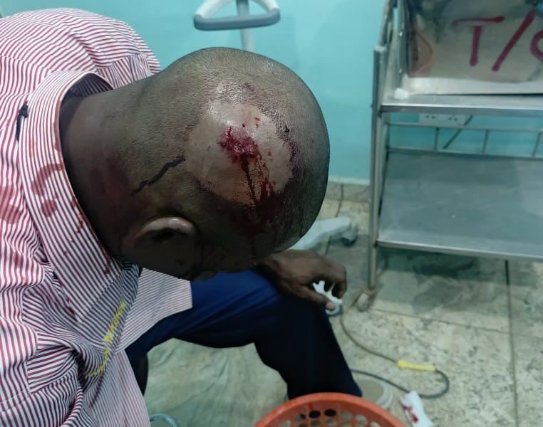 Wikki Tourists Clarify Circumstances Surrounding Injury to Katsina United Chairman