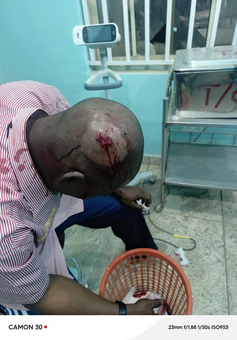 Wikki Tourists Clarify Circumstances Surrounding Injury to Katsina United Chairman